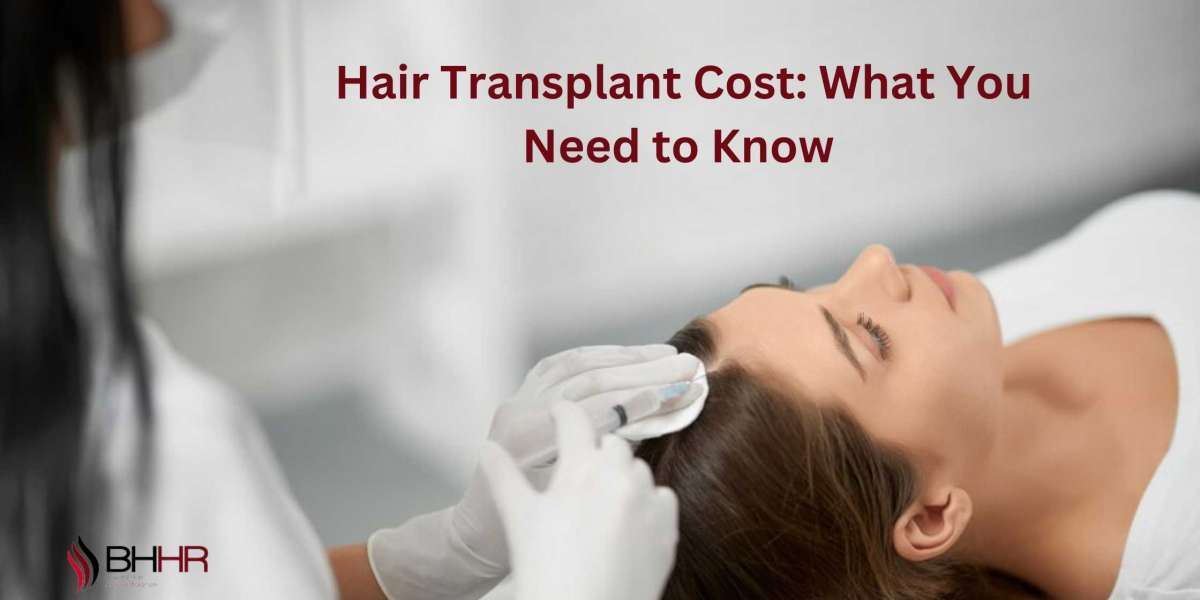 Hair Transplant Cost: What You Need to Know