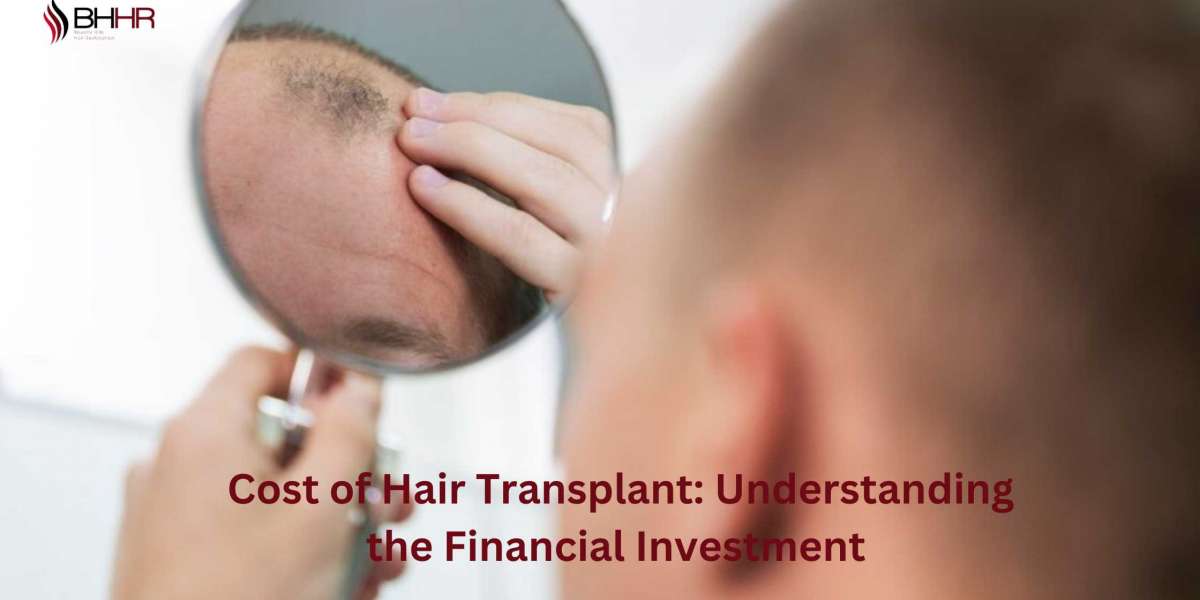Cost of Hair Transplant: Understanding the Financial Investment 