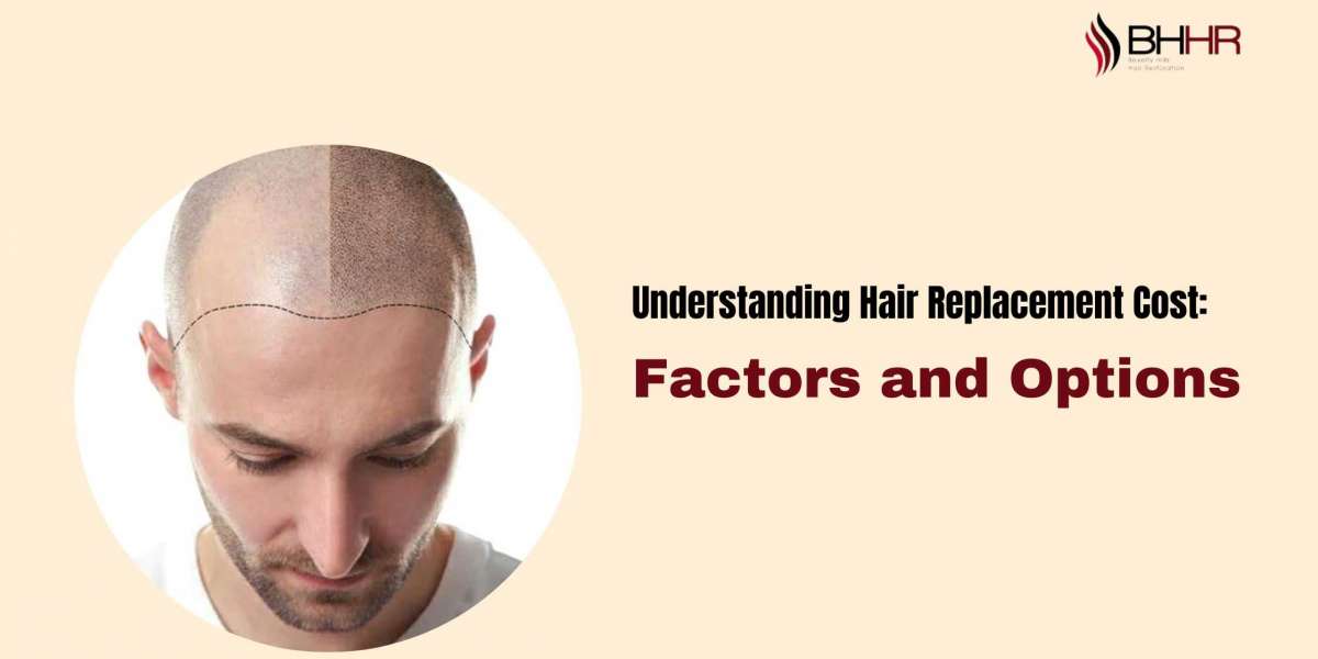 Understanding Hair Replacement Cost: Factors, Options