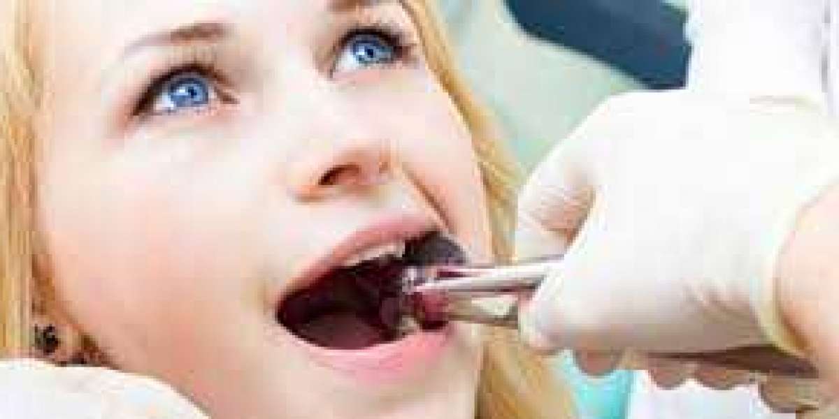 Tooth Extraction in Rockport, TX: What You Need to Know