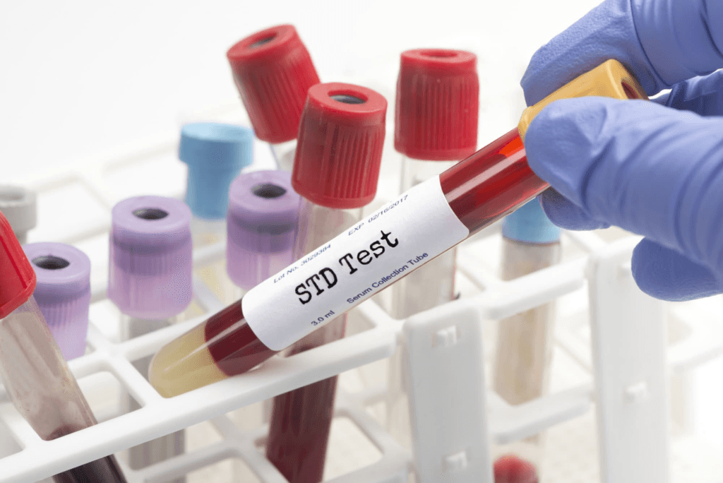 Your Privacy Is Paramount: What To Expect From Discreet STD Check Ups