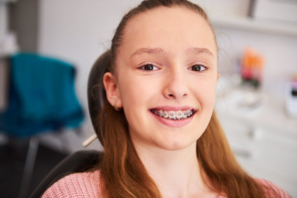 Teeth Braces in Abu Dhabi | Invisible Braces Abu Dhabi