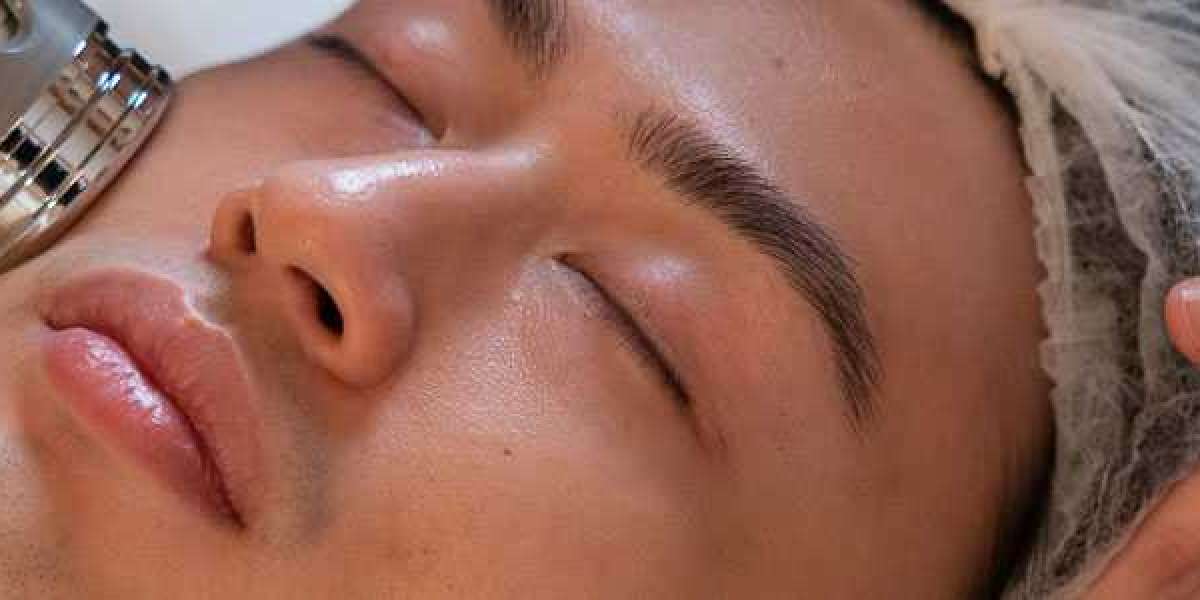 men facial singapore