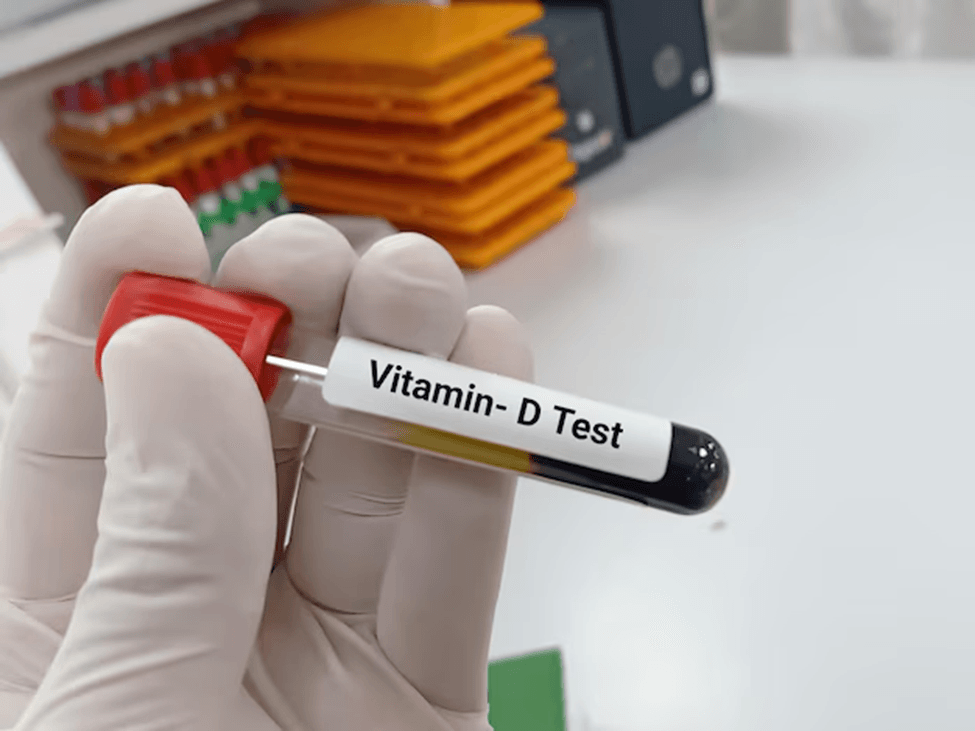 Low Energy? Weak Bones? Consider Getting a Vitamin D Test at Home in Dubai