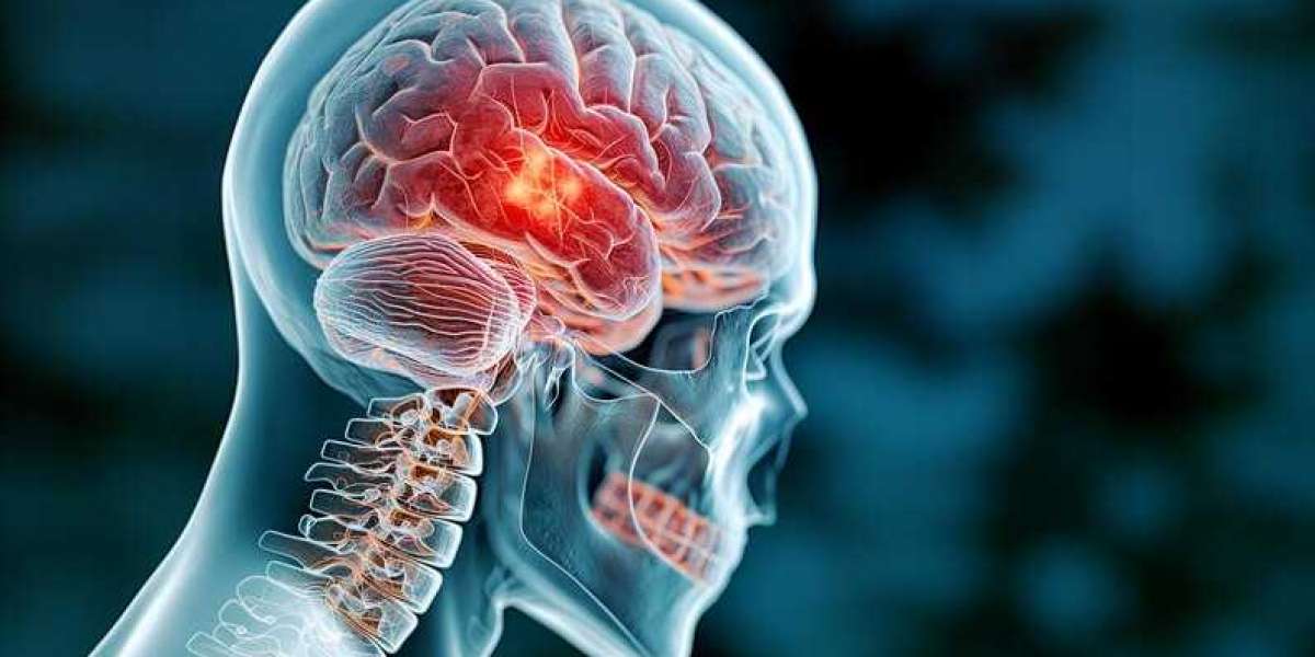 Siderosis Global Market Intelligence: Regional Analysis and Emerging Market Opportunities