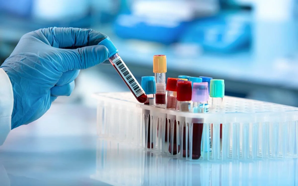 How At-Home Blood Tests Are Revolutionizing Healthcare in Dubai