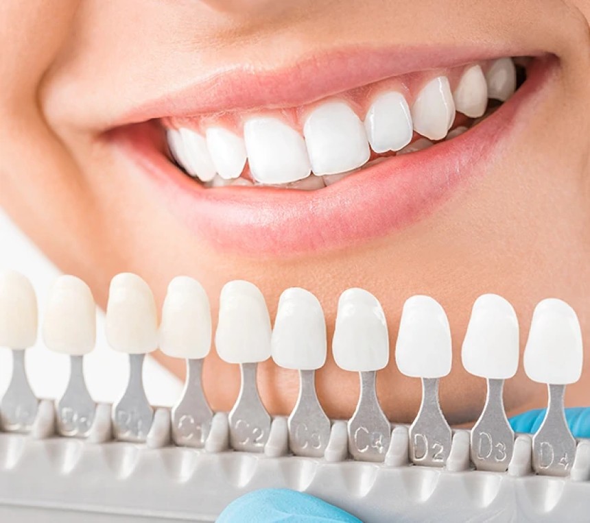 Blogs - Bang Box online - Why a Cosmetic Dentist in Louisville Is the Key to Your Dream Smile