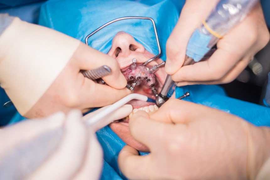 Blogs - Bang Box online - What to Expect at a Trusted Oral Surgery & Implant Center in Concord