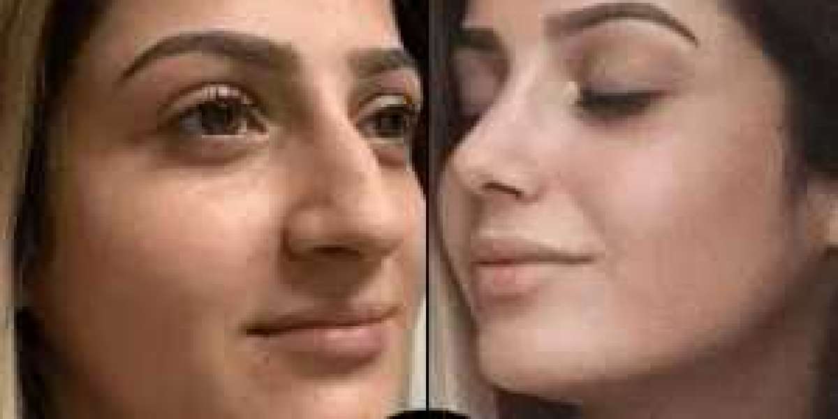 Article Picture