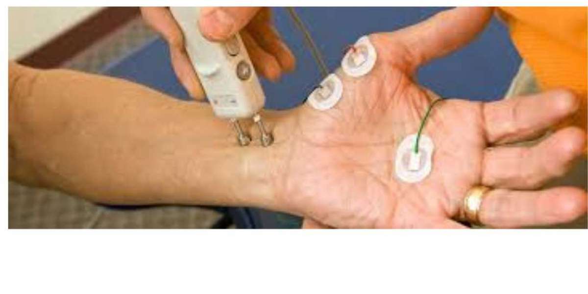 NCV Test Near Me: Understanding Its Importance for Nerve Health
