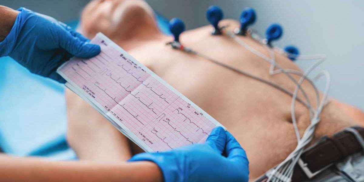 Best Echocardiography Testing Centres in Bangalore: A Complete Guide to Heart Health