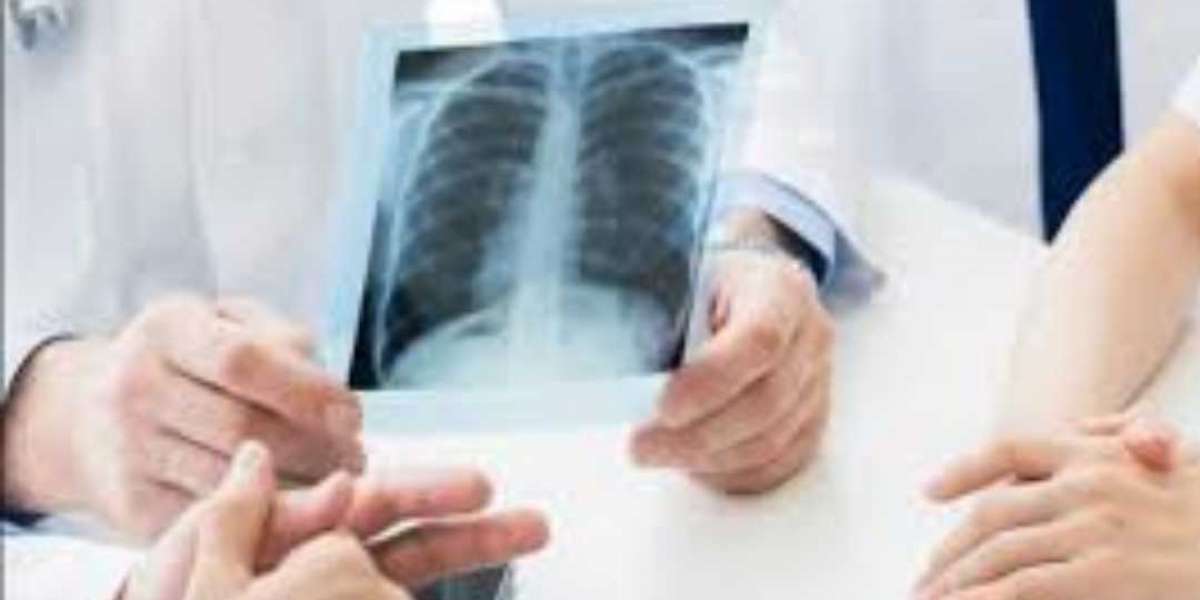 X-Ray OPG Scan in Bengaluru: Everything You Need to Know About This Digital Dental Imaging Test