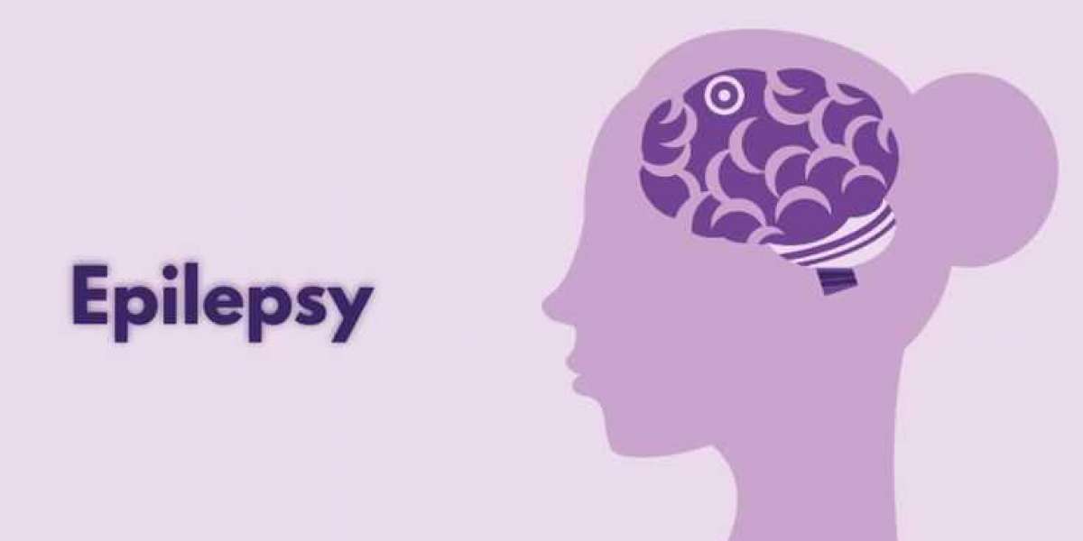 How Lyrica 300mg Helps Control Epilepsy