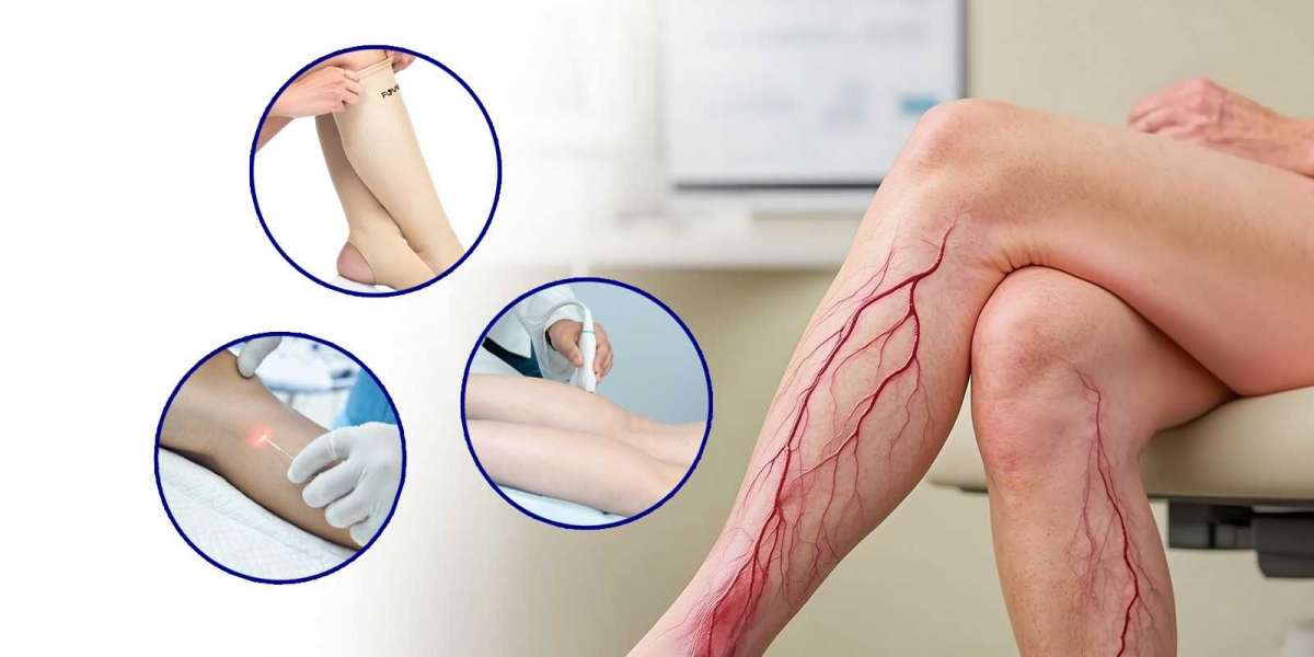 Top Varicose Veins Doctors Near Me – Safe & Effective Solutions