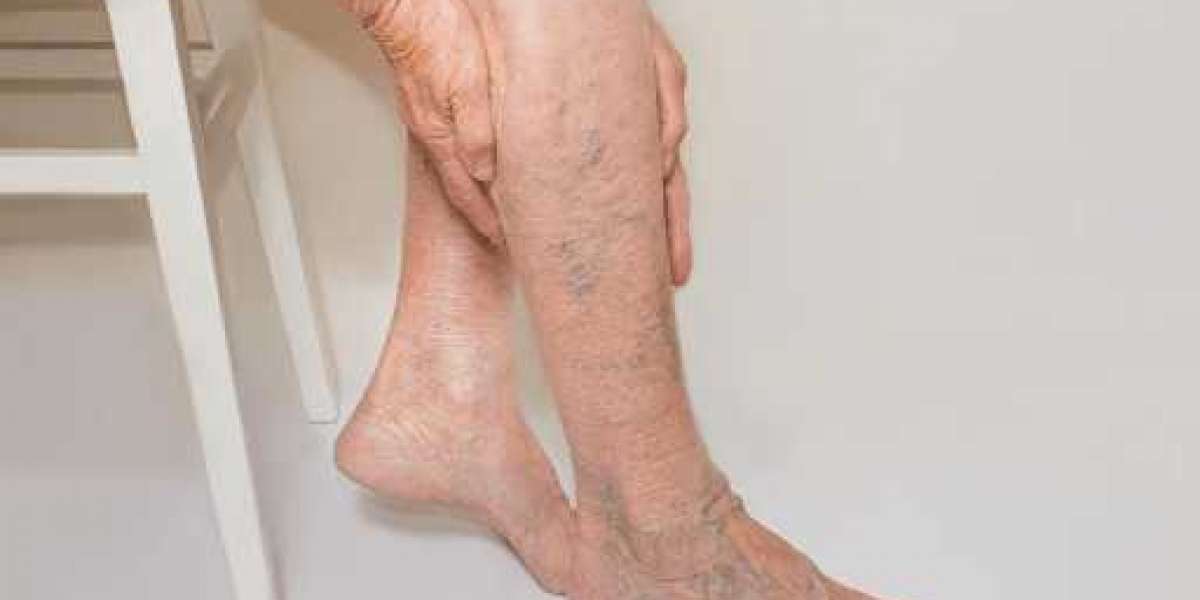 https://www.facebook.com/Venovixil.Vein.Care.Cream.Canada.Reviews/