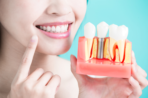 Restore Your Smile and Confidence with Dentures – BDnews55.com