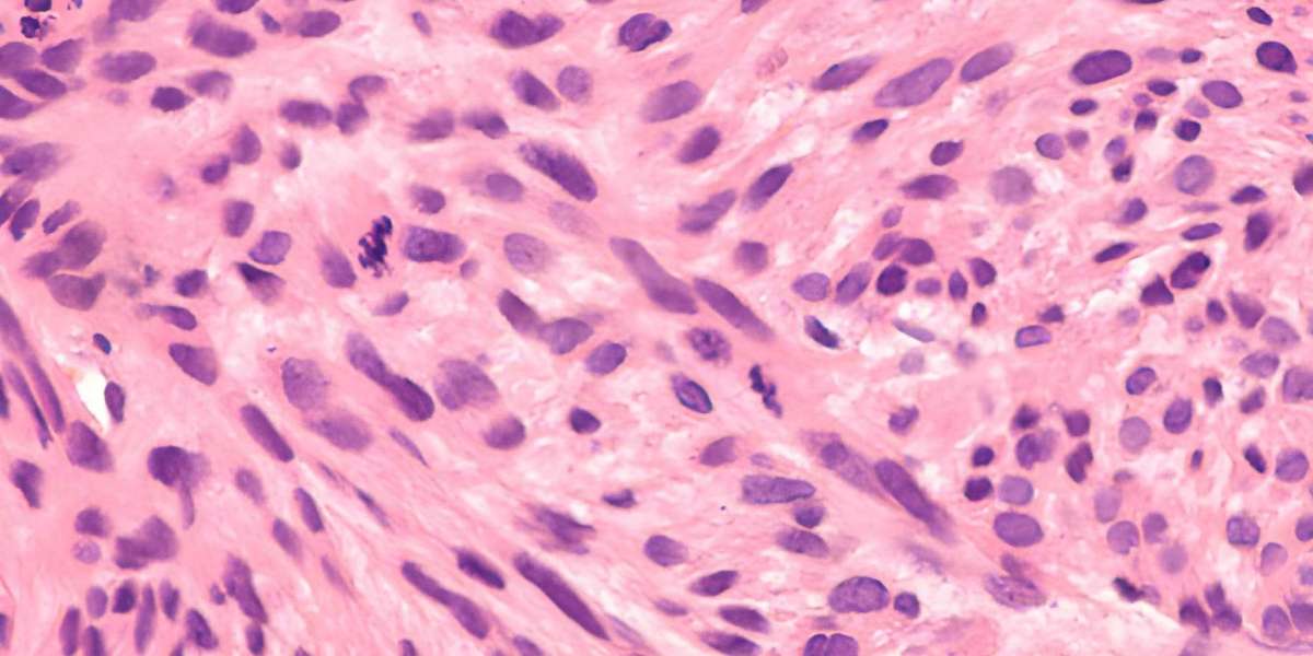 Article Picture