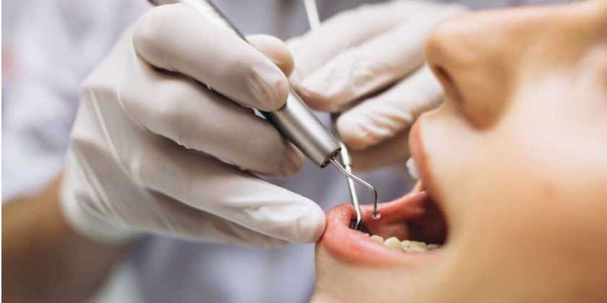 Root Canal Treatment in Vikaspuri – Save Your Natural Tooth with Expert Dental Care