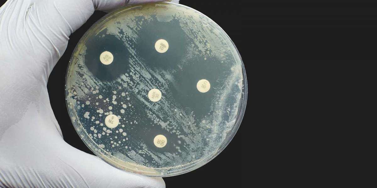 Antimicrobial Cap Fitters Market 2025 Size, Growth Analysis Report, Forecast to 2035