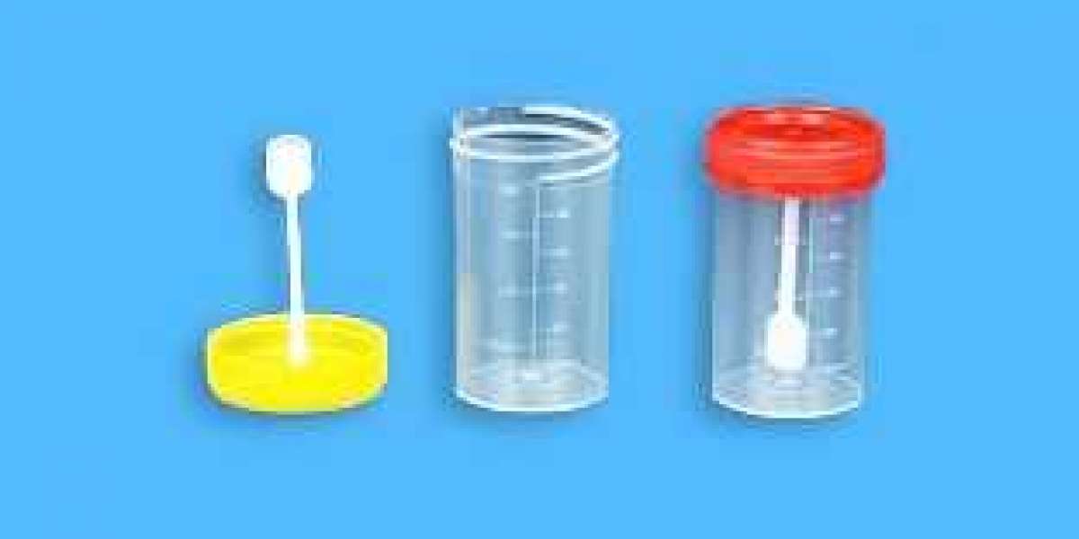 Why Proper Urine Collection Matters for Accurate Test Results